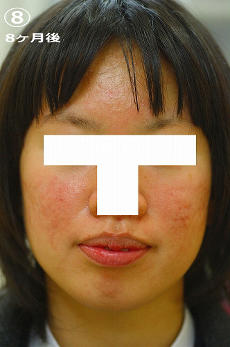 8ヶ月後