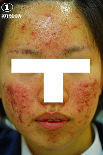 初診時