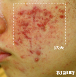 拡大 初診時