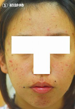 初診時
