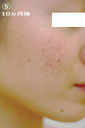 10������