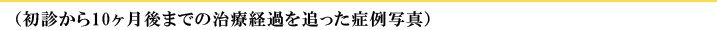 (初診から10ヶ月後までの治療経過を追った症例写真)
