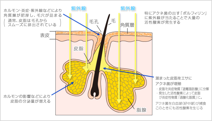 �u�j�L�r�̒�`�v�̐}